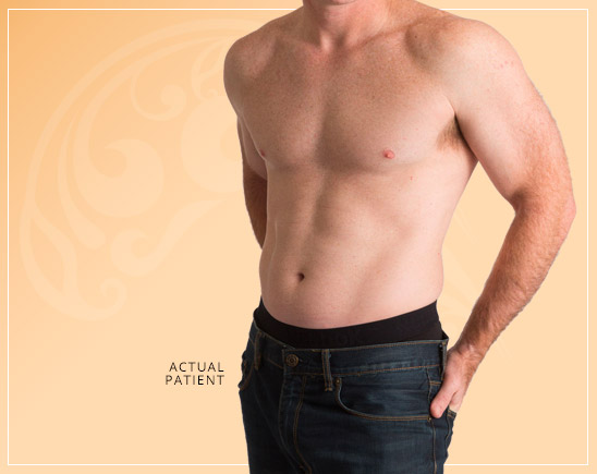Dr. Palladino consulting with a patient on gynecomastia surgery preparation
