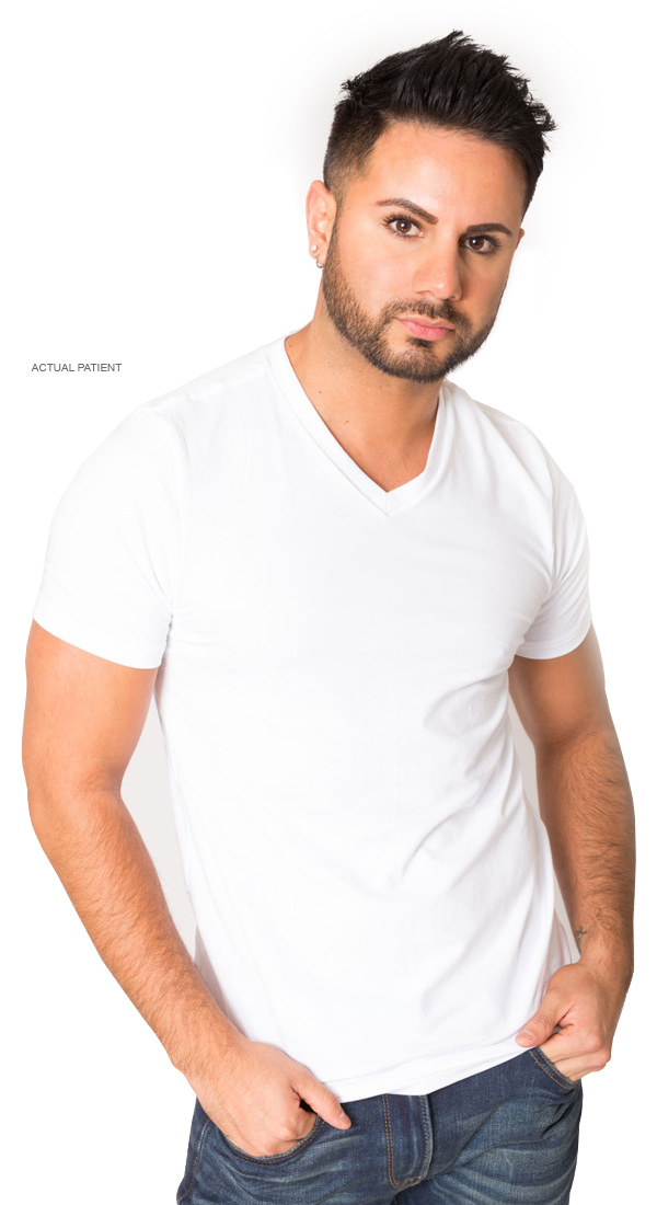 Men's rhinoplasty consultation with Dr. Palladino in Fort Lauderdale