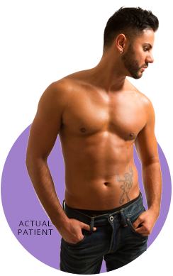 Gynecomastia surgery, male breast reduction