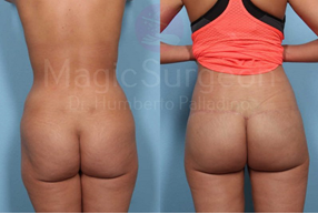 Exercises for a saggy butt cheap